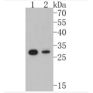 Anti-NQO1antibody-醌氧化還原酶重組兔單抗