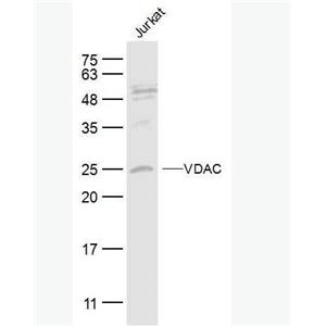 Anti-VDAC (Mitochondrial Loading Control)antibody-等電壓依賴性陰離子通道（內(nèi)參）抗體