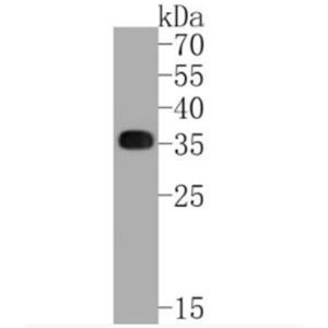 Anti-HLA-DR antibody-HLA-DR重組兔單抗