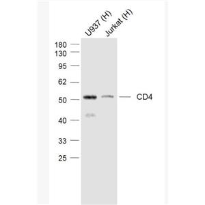 Anti-CD4 antibody-CD4重組兔單抗