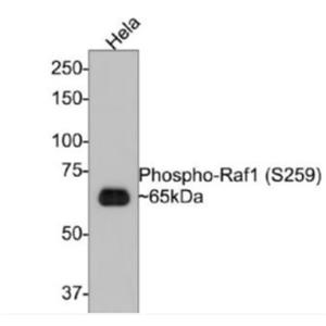 Anti-phospho-RAF1 (Ser259) antibody-磷酸化原癌基因RAF1重組兔單抗