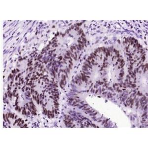 Anti-phospho-C-Myc (Ser62)antibody-磷酸化致癌基因C-Myc重組兔單抗