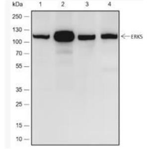 Anti-ERK5 antibody-細胞外信號調(diào)節(jié)激酶5重組兔單抗