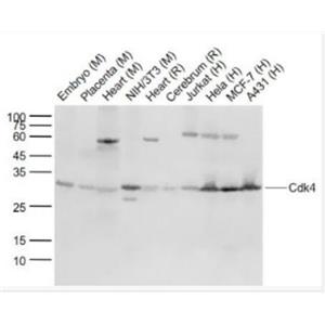 Anti-Cdk4 antibody-周期素依賴性激酶4單克隆抗體