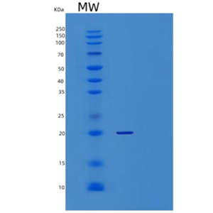 Recombinant Human α-Crystallin A Chain/CRYAA Protein(C-6His)