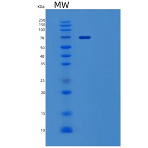 Recombinant Mouse Tyrosine-Protein Kinase Receptor TYRO3/DTK Protein(C-Fc)