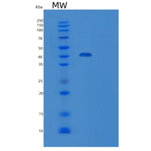 Recombinant Human GITR/TNFRSF18/CD357 Protein(C-Fc)