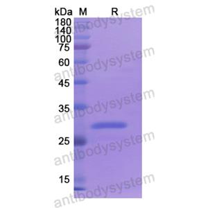 Recombinant Human ABCC3, N-His