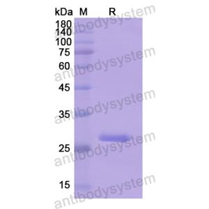 Recombinant Human ABCC4, N-His