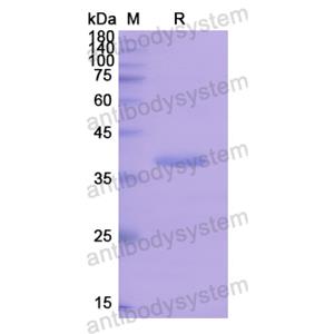 Recombinant Human OGG1, N-His