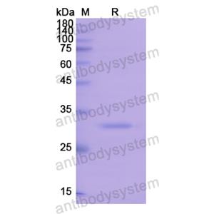 Recombinant Human PDK1/PDPK1, N-His