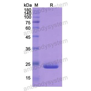 Recombinant Human CYP26A1, N-His