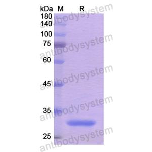 Anti-HRSV-A/BRSV F/Fusion glycoprotein F0 Antibody (B4-1) 