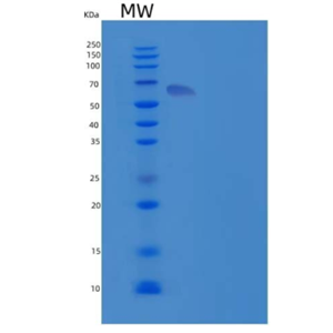 Recombinant Human Tissue-Type Plasminogen Activator/PLAT Protein(C-6His)