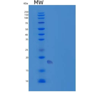 Recombinant Human TMIGD2/IGPR-1/CD28H Protein(C-6His)