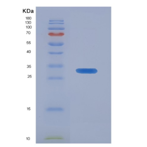 Recombinant Insulin Like Growth Factor 2 mRNA Binding Protein 2 (IGF2BP2)