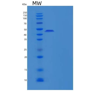 Recombinant Human Acid sphingomyelinase-like phosphodiesterase 3a Protein