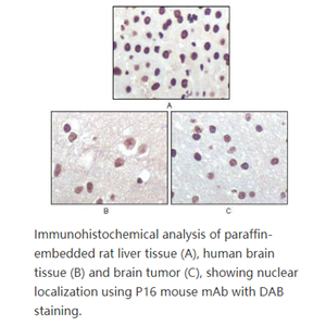 P16 (Mouse and Human)