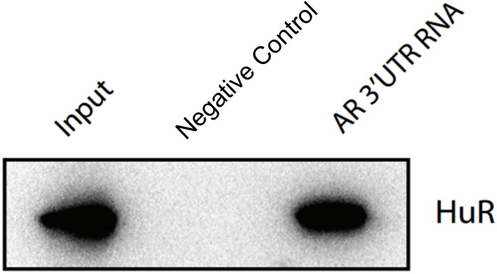 RNA Pull-down