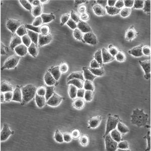 NCI-H1299 Cells人非小細(xì)胞肺癌復(fù)蘇細(xì)胞系(有STR鑒定圖譜)