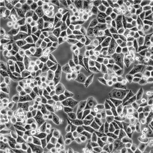 NCI-H292 Cells人肺癌復(fù)蘇細(xì)胞系<淋巴結(jié)轉(zhuǎn)移>(有STR鑒定圖譜)